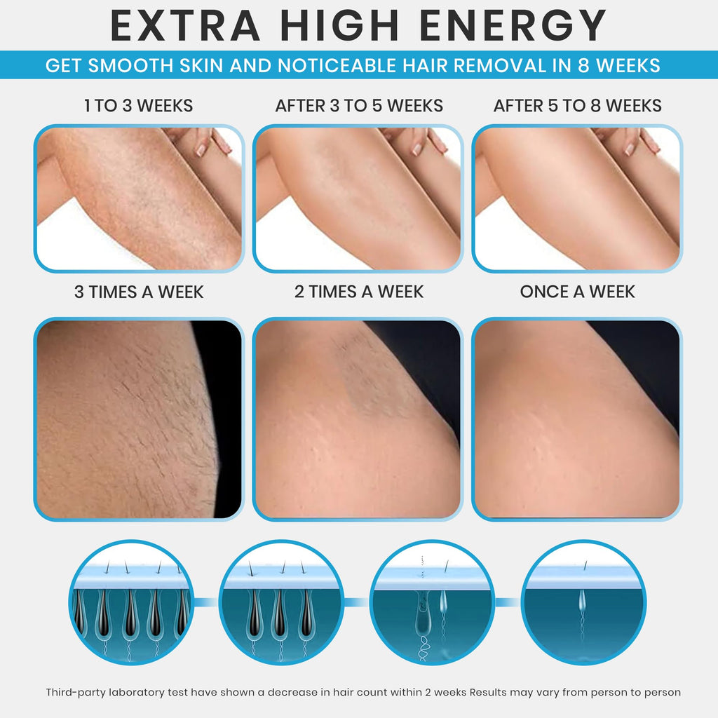 IPL Laser Hair Removal Device for Women & Men (White) N98001
