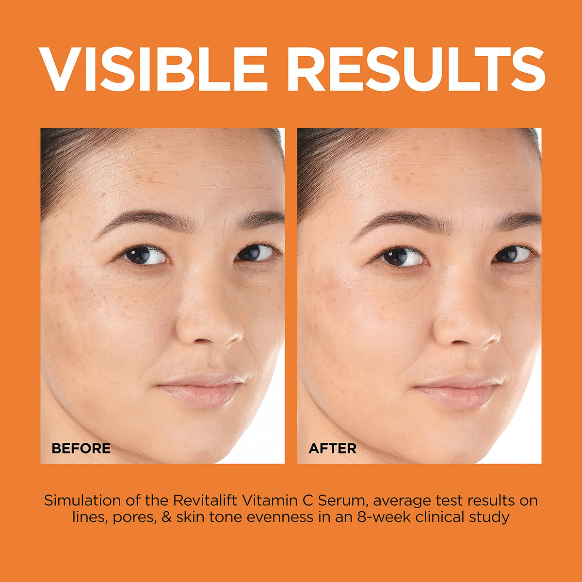 Vitamin C Brightening Face Serum with Vitamin E, Salicylic Acid, 1 oz E9079