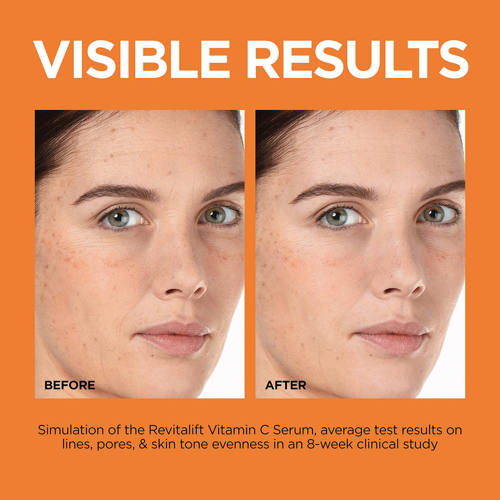 Vitamin C Brightening Face Serum with Vitamin E, Salicylic Acid, 1 oz E9079